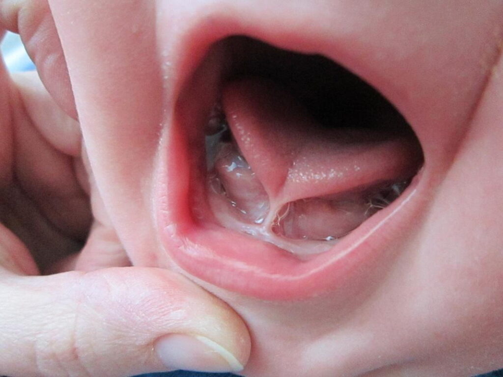 Pediatric Dentistry Near Me