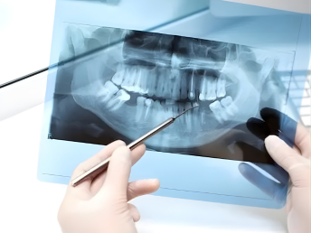 Dental X Ray