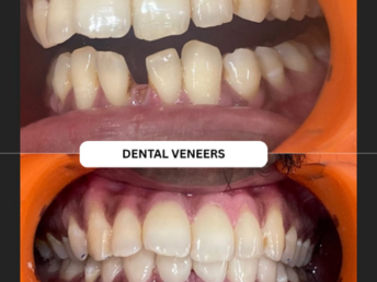 Cosmetic Dentistry